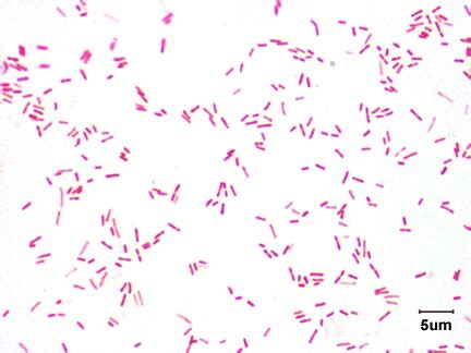 BIOL 230 Lab Manual: Gram Stain of Pseudomonas aeruginosa