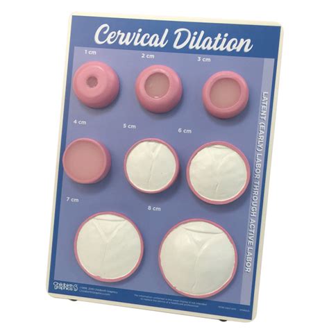 Cervical Dilation Easel Display | Childbirth Graphics