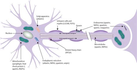 Spastic Paraplegia, Hereditary; Hereditary Spastic Paraplegia; X-Linked ...