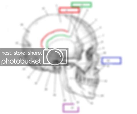 Bony Landmarks of the Lateral Skull Quiz - By Gn4rcot1cs