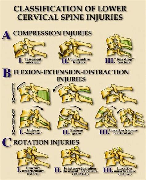 Thoracic and Cervical Spine Injury | Cervical, Thoracic, Spine surgery