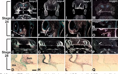 Palatine bone structure | Semantic Scholar