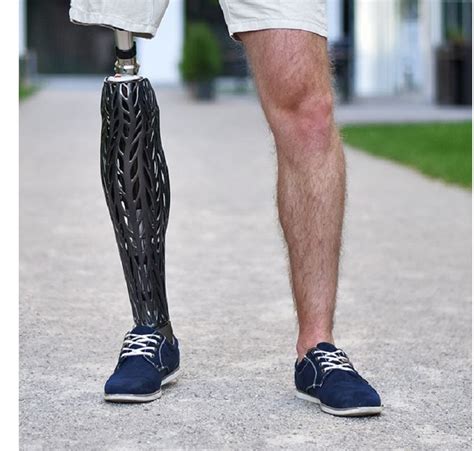 Prosthesis Cover Shopping Guide for Amputees | Amplitude