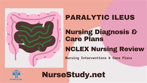 Paralytic Ileus Nursing Diagnosis & Care Plan - NurseStudy.Net