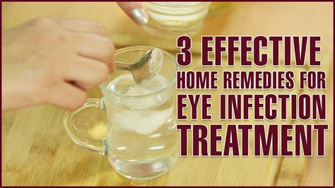 3 Easy & Effective Home Remedies For EYE INFECTION TREATMENT - YouTube