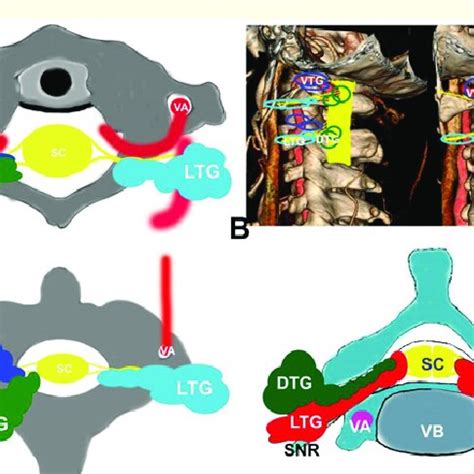 Schematic representation of the types of tumor growth on which the ...