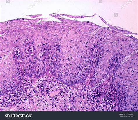 Stratified Squamous Epithelium Non Keratinized Esophagus