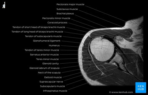 Normal shoulder MRI: How to read a shoulder MRI | Kenhub