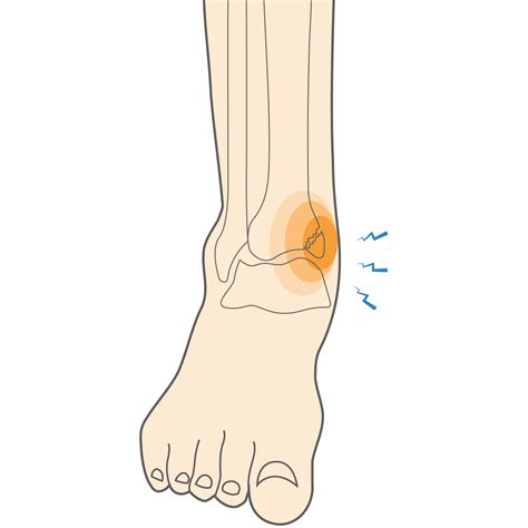 Medial Malleolus