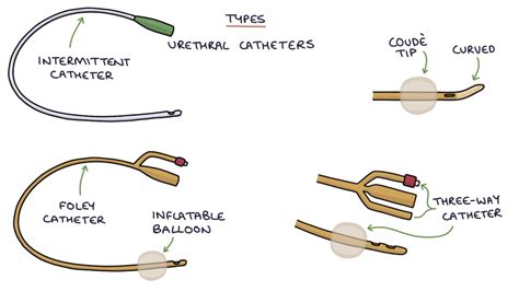 Urinary Catheter Types