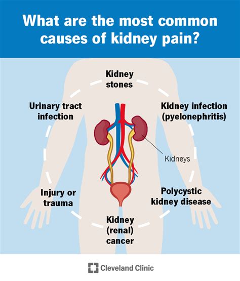 Kidney Pain Location