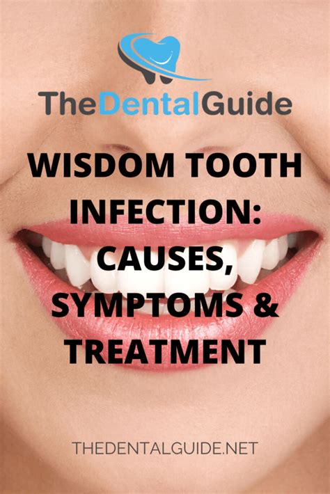 Wisdom Tooth Infection: Causes, Symptoms & Treatment - The Dental Guide