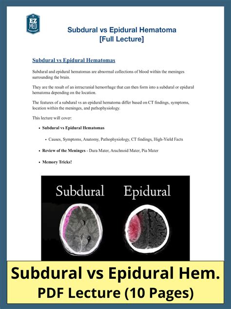 Epidural Hematoma Ct Findings