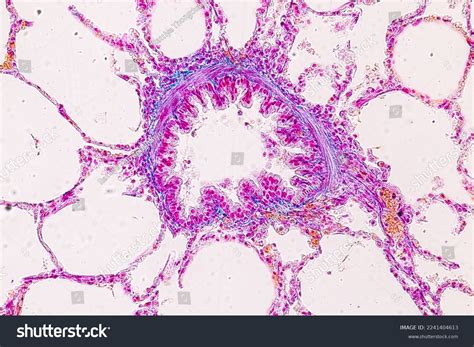 Lung Pituitary Gland Human Under Microscope Stock Photo 2241404613 ...