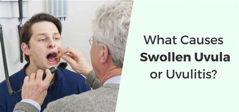 Swollen Uvula (Uvulitis): Causes, Symptoms & Natural Treatments