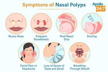 Symptoms Nose