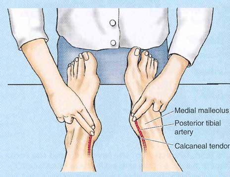 Pulse Palpation - Article of the Day - English en 2024