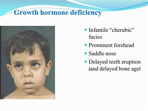 Growth Hormone Deficiency in Children: Causes, Symptoms, and Treatment ...