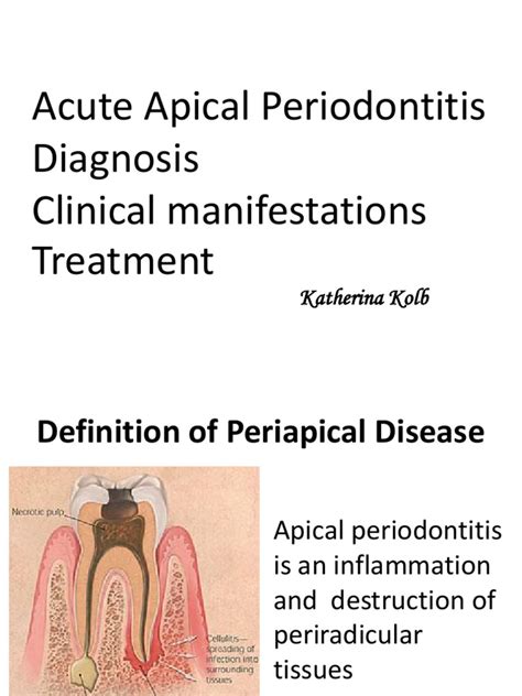 Lecture - 6-6 - Acute Apical Periodontitis Diagnosis Clinical ...