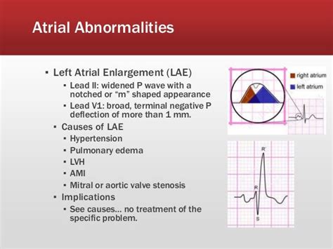 TCAD - Multi-lead ECG