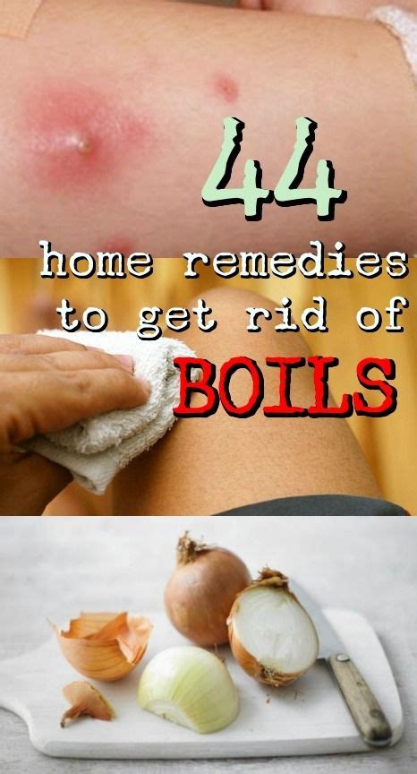 87 Best Armpit boils treatment at home for New Design | Ideas Home and ...