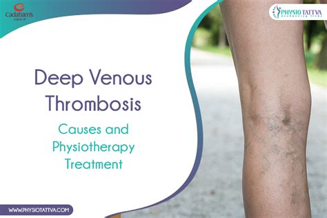 Diagnosis & Treatment of Deep Venous Thrombosis