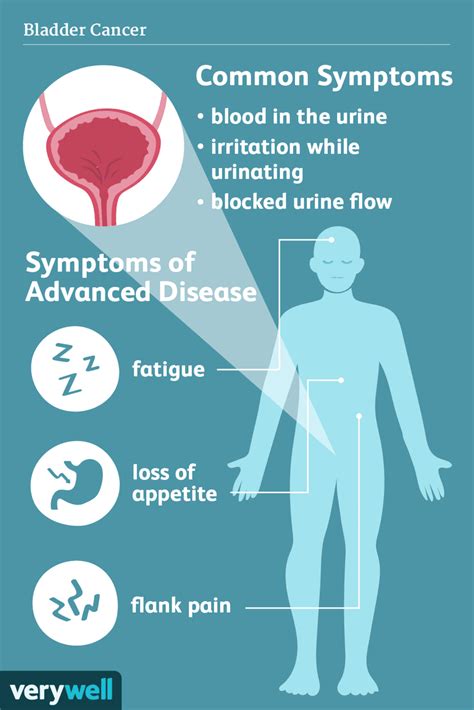 Signs and Symptoms of Bladder Cancer