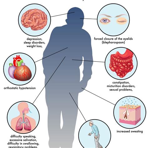 Parkinson’s Disease: Early Symptoms and When to See a Neurologist ...