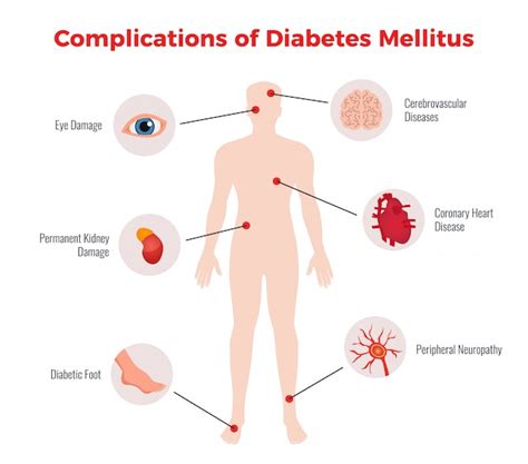 Diabetes Complications Images | Free Vectors, Stock Photos & PSD