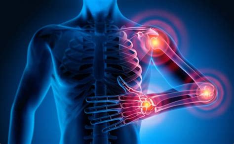 What are the different types of connective tissue diseases?