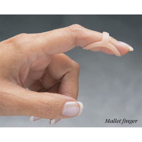 Oval-8 Mallet Finger Splint Singapore - Oval 8 Trigger Finger Splint ...