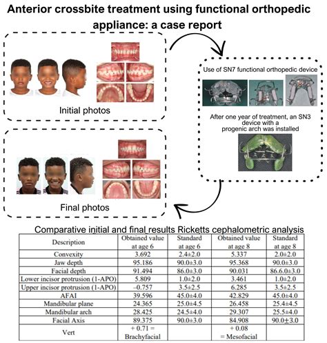 Anterior crossbite treatment using functional orthopedic appliance: a ...