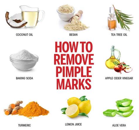 How To Remove Pimple Marks 12 Effective Ways | Femina.in