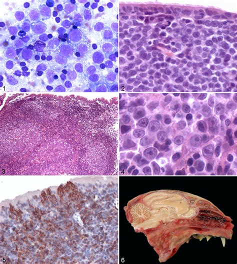 Large Diffuse B Cell Lymphoma Symptoms