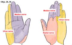 Pin on HEALTH - Peripheral Neuropathy