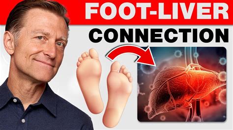 9 Things your feet can tell about your Liver | Sports Health & WellBeing