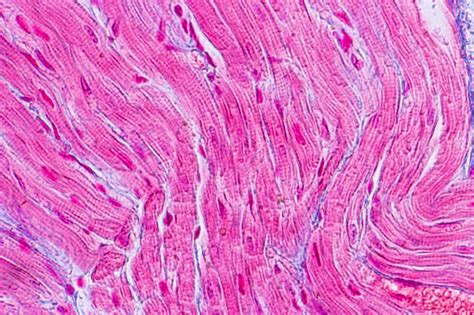 Anatomi Pendidikan Dan Sampel Histologis Jaringan Otot Jantung Di Bawah ...