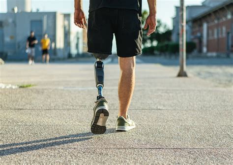 Is a Prosthetic Worth It? Can You Walk Normally with a Prosthetic Leg?