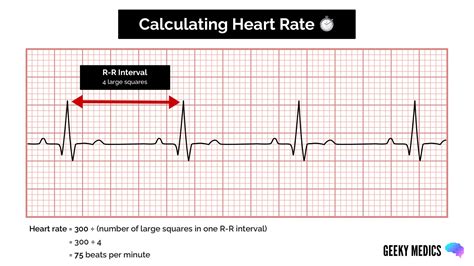 Ekg Heart Rate Calculator