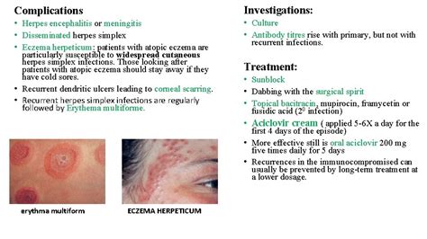 Viral Skin Infections Presented by Laith Sorour Herpes