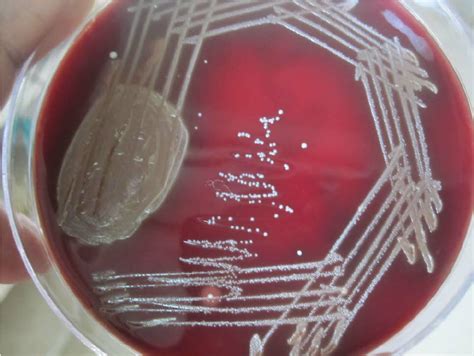 Streptococcus Mutans On Blood Agar