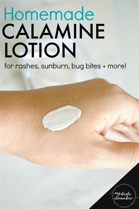 Homemade Calamine Lotion (for rashes, sunburn, bug bites & more | Anti ...