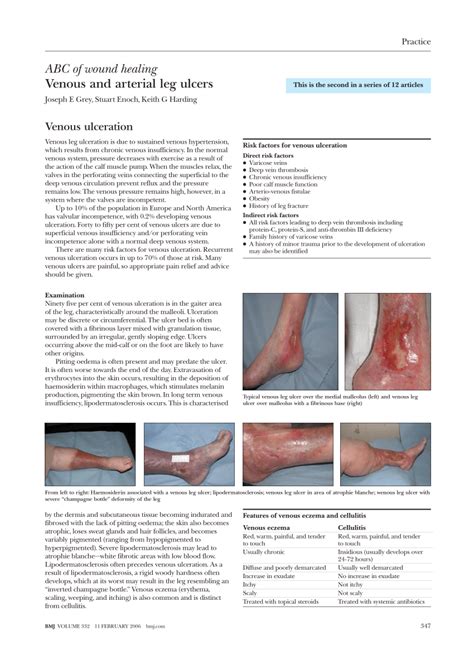 Abc Of Wound Healing Venous And Arterial Leg Ulcers | The Best Porn Website