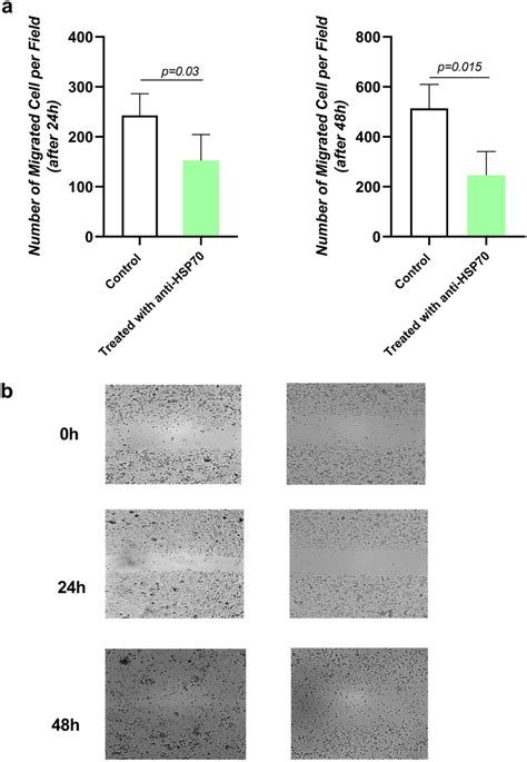 The wound Healing assay has approved a low number of cancer cells ...