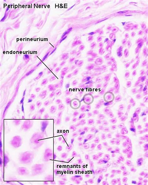 File:Peripheral nerve histology 01.jpg - Embryology