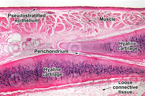 Tracheal Cartilage Histology