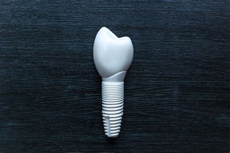 Metal-Free Dental Implants - Ceramic and Zirconia: SDAI Sydney CBD