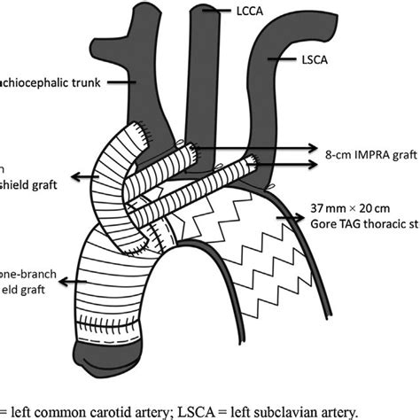 A detailed illustration shows the anatomic relationships and the frozen ...