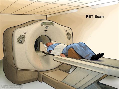 Adult Central Nervous System Tumors Treatment - NCI