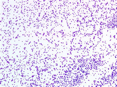 Staphylococcus aureus morphology visualised using Gram staining (10× ...